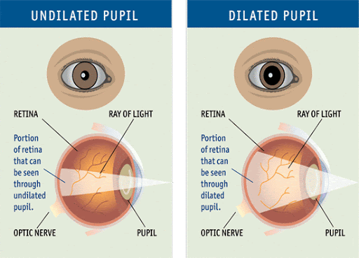 opticians, eye exam, sight test, pupil reflex, retina, light, Oodo™