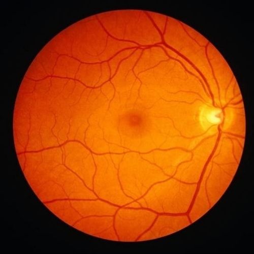 retinal view, opticians, eye exam, sight test, Oodo™